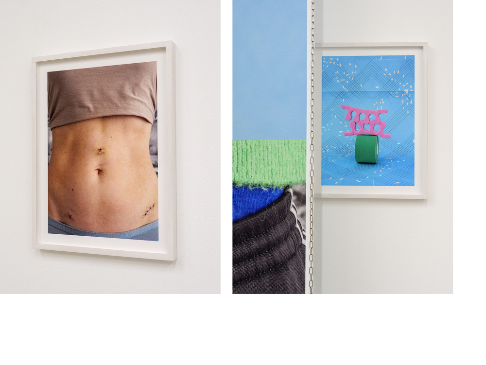 The Cut - gerahmte Fotografie + Textilarbeit, Metallkette, gerahmte Fotografie
